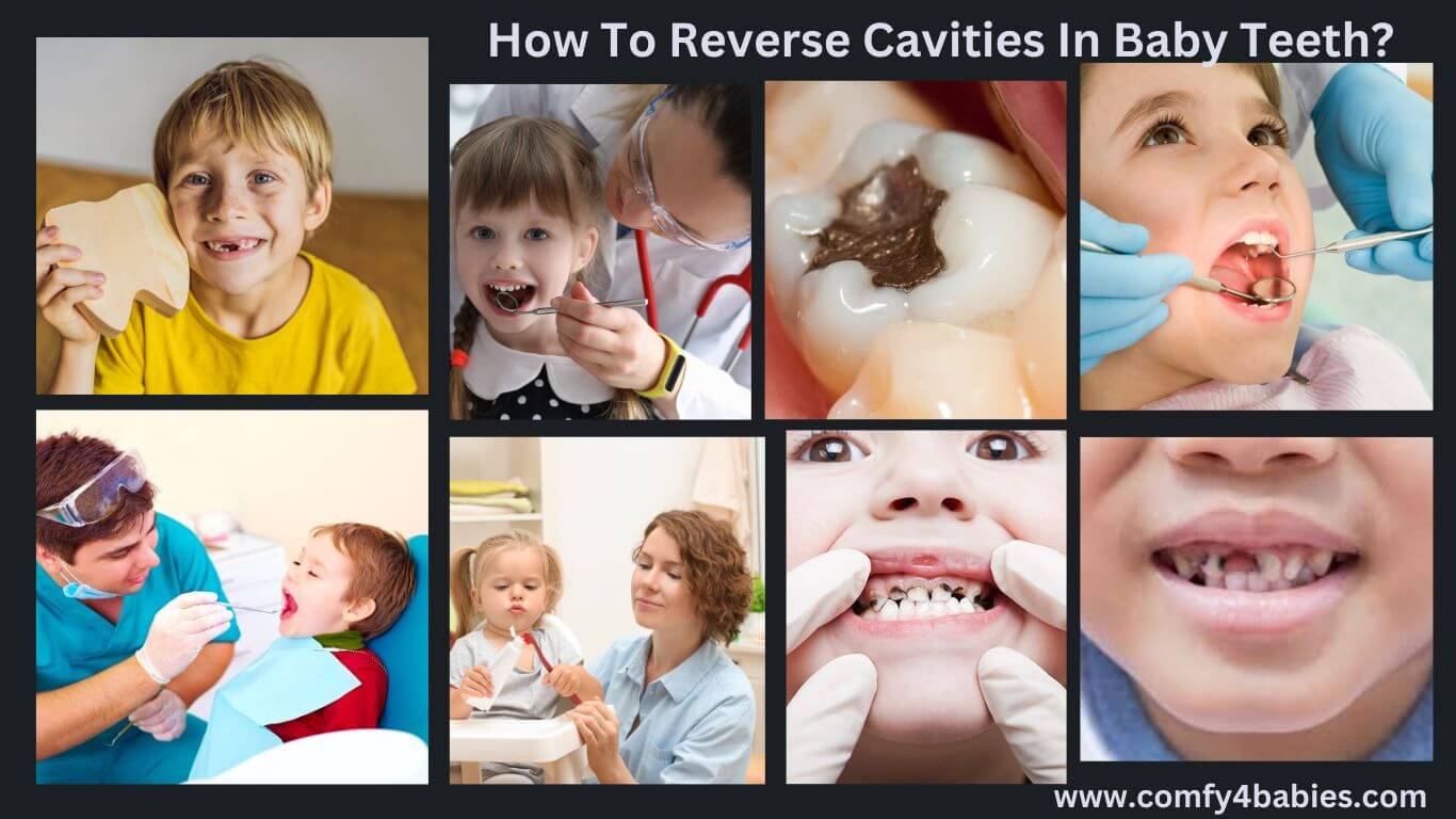 reverse cavities in baby teeth